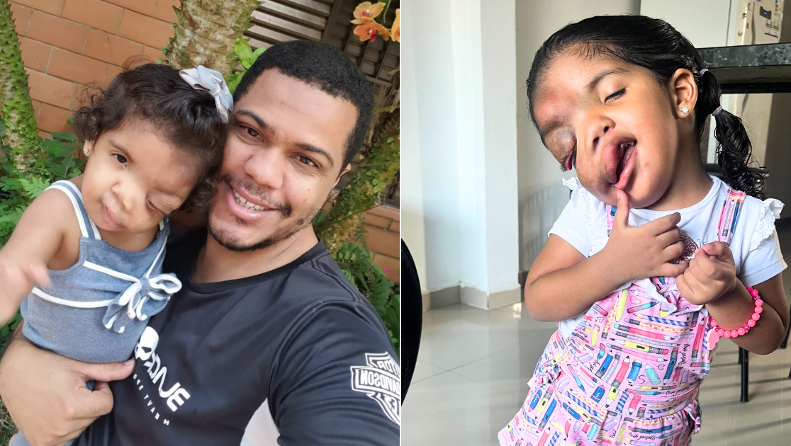Banner Filho com tumor na boca cuida sozinho do pai idoso e acamado que tem Alzheimer e Parkinson